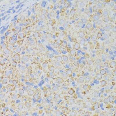 Immunohistochemistry-Paraffin: ACADL Antibody [NBP2-92854] - Rat ovary using ACADL antibody at dilution of 1:100 (40x lens).