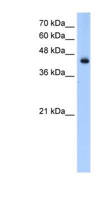 Western Blot: ACADL Antibody [NBP1-54936] - Transfected 293T cell lysate, concentration 0.2-1 ug/ml.