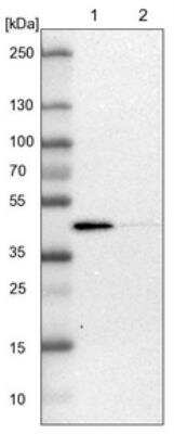 Western Blot: ACADL Antibody [NBP1-89289] - Lane 1: NIH-3T3 cell lysate (Mouse embryonic fibroblast cells). Lane 2: NBT-II cell lysate (Rat Wistar bladder tumor cells).