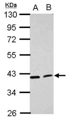 Western Blot: ACADL Antibody [NBP2-15235] - Sample (30 ug of whole cell lysate) A: H1299 B: HCT116 10% SDS PAGE; antibody diluted at 1:1000.