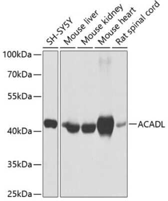 Western Blot: ACADL Antibody [NBP2-92854] - Analysis of extracts of various cell lines, using ACADL at 1:1000 dilution.Secondary antibody: HRP Goat Anti-Rabbit IgG (H+L) at 1:10000 dilution.Lysates/proteins: 25ug per lane.Blocking buffer: 3% nonfat dry milk in TBST.Detection: ECL Basic Kit .Exposure time: 1s.