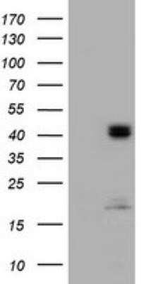 Western Blot: ACADS Antibody (OTI1D2) - Azide and BSA Free [NBP2-70061] - Analysis of HEK293T cells were transfected with the pCMV6-ENTRY control (Left lane) or pCMV6-ENTRY ACADS.