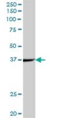 Western Blot: ACADS Antibody [H00000035-B01P] - Analysis of ACADS expression in human liver.