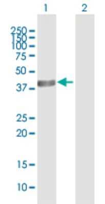 Western Blot: ACADS Antibody [H00000035-B01P] - Analysis of ACADS expression in transfected 293T cell line by ACADS polyclonal antibody.  Lane 1: ACADS transfected lysate(45.32 KDa). Lane 2: Non-transfected lysate.