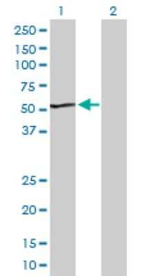 Western Blot: ACADS Antibody [H00000035-D01P] - Analysis of ACADS expression in transfected 293T cell line by ACADS polyclonal antibody.Lane 1: ACADS transfected lysate(44.30 KDa).Lane 2: Non-transfected lysate.
