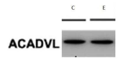 Western Blot: ACADVL Antibody (5D3) [H00000037-M01] - Alcohol feeding showed no significant effect on the expression of ACADVL in mouse liver. Image from verified customer review.