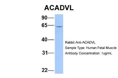 Western Blot: ACADVL Antibody [NBP1-54378] - Sample Type: Human Fetal Muscle Antibody Dilution: 1.0 ug/ml