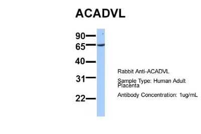 Western Blot: ACADVL Antibody [NBP1-54378] - Sample Type: Human Adult Placenta Antibody Dilution: 1.0 ug/ml