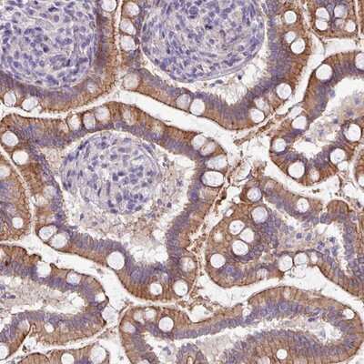 Immunohistochemistry-Paraffin ACAP3 Antibody - BSA Free