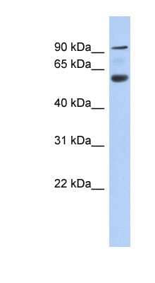 Western Blot: ACAP3 Antibody [NBP1-70400] - Human Pancrease lysate, concentration 0.2-1 ug/ml.
