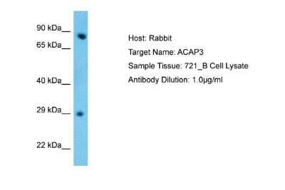 Western Blot: ACAP3 Antibody [NBP2-86942] - Host: Rabbit. Target Name: ACAP3. Sample Type: 721_B Whole Cell. Antibody Dilution: 1.0ug/ml