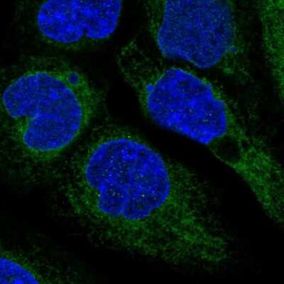 Immunocytochemistry/Immunofluorescence: ACAT Antibody [NBP2-32052] - Immunofluorescent staining of human cell line A-431 shows localization to endoplasmic reticulum.