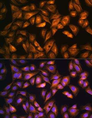 Immunocytochemistry/Immunofluorescence: ACAT Antibody [NBP2-92471] - Analysis of U2OS cells using SOAT1 Rabbit pAb at dilution of 1:100. Blue: DAPI for nuclear staining.