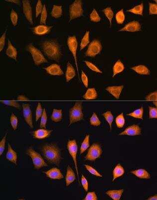 Immunocytochemistry/Immunofluorescence: ACAT Antibody [NBP2-92471] - Analysis of L929 cells using SOAT1 Rabbit pAb at dilution of 1:100. Blue: DAPI for nuclear staining.