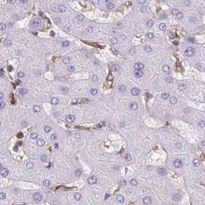 Immunohistochemistry: ACAT Antibody [NBP2-32052] - Staining of liver.