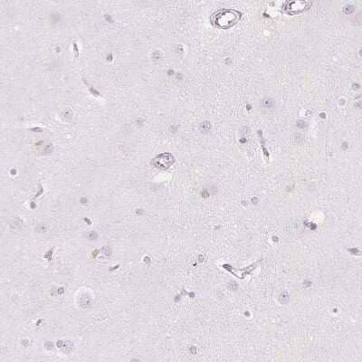 Immunohistochemistry-Paraffin: ACAT Antibody [NBP2-32052] - Staining of human cerebral cortex shows low expression as expected.