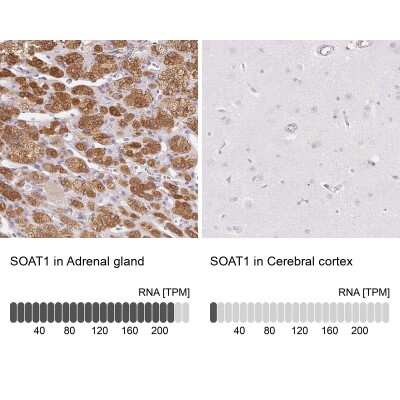 <b>Orthogonal Strategies Validation. </b>Immunohistochemistry-Paraffin: ACAT Antibody [NBP2-32052] - Staining in human adrenal gland and cerebral cortex tissues using anti-SOAT1 antibody. Corresponding SOAT1 RNA-seq data are presented for the same tissues.