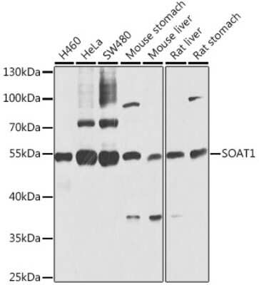 Western Blot: ACAT Antibody [NBP2-92471] - Analysis of extracts of various cell lines, using ACAT at 1:1000 dilution. Secondary antibody: HRP Goat Anti-Rabbit IgG (H+L) at 1:10000 dilution. Lysates/proteins: 25ug per lane. Blocking buffer: 3% nonfat dry milk in TBST. Detection: ECL Basic Kit . Exposure time: 10s.