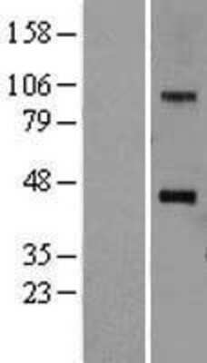 Western Blot: ACAT Overexpression Lysate (Adult Normal) [NBP2-10868] Left-Empty vector transfected control cell lysate (HEK293 cell lysate); Right -Over-expression Lysate for ACAT.