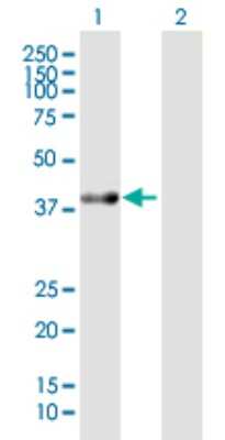 Western Blot: ACAT2 Antibody [H00000039-B01P] - Analysis of ACAT2 expression in transfected 293T cell line by ACAT2 polyclonal antibody.  Lane 1: ACAT2 transfected lysate(43.67 KDa). Lane 2: Non-transfected lysate.