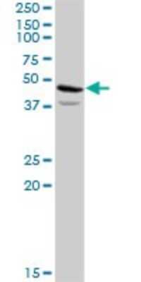 Western Blot: ACAT2 Antibody [H00000039-D01P] - Analysis of ACAT2 expression in human liver.