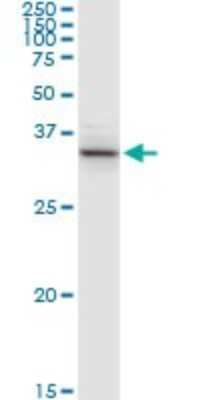 Western Blot: ACAT2 Antibody [H00000039-D01P] - Analysis of ACAT2 expression in mouse spleen.