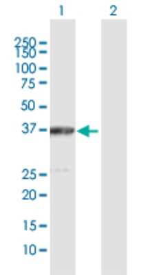 Western Blot: ACAT2 Antibody [H00000039-D01P] - Analysis of ACAT2 expression in transfected 293T cell line by ACAT2 polyclonal antibody.Lane 1: ACAT2 transfected lysate(41.40 KDa).Lane 2: Non-transfected lysate.