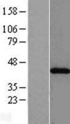 Western Blot ACAT2 Overexpression Lysate