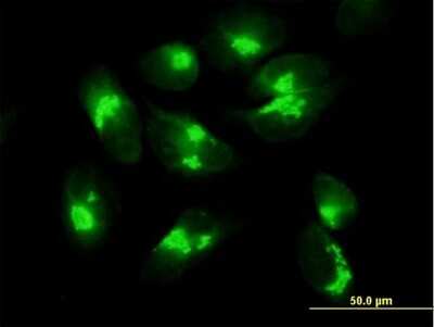 Immunocytochemistry/Immunofluorescence: ACBD3 Antibody [H00064746-B01P] - Analysis of purified antibody to ACBD3 on HeLa cell. (antibody concentration 10 ug/ml)
