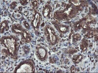 Immunohistochemistry: ACBD3 Antibody (OTI1G2) - Azide and BSA Free [NBP2-72148] - Analysis of Human breast tissue.