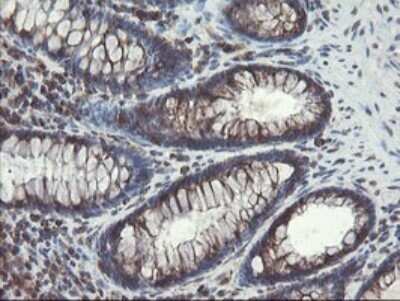 Immunohistochemistry: ACBD3 Antibody (OTI1G2) - Azide and BSA Free [NBP2-72148] - Analysis of Human colon tissue.