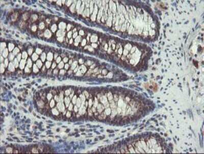 Immunohistochemistry: ACBD3 Antibody (OTI3A1) - Azide and BSA Free [NBP2-72149] - Staining of paraffin-embedded Human colon tissue using anti-ACBD3 mouse monoclonal antibody.