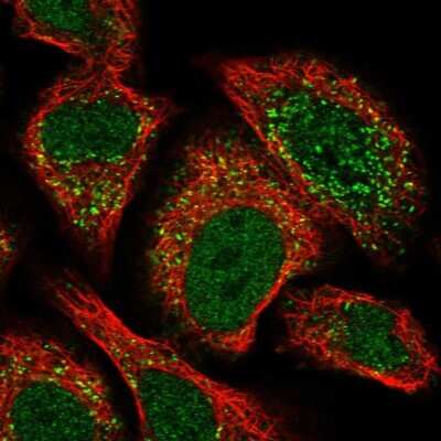 Immunocytochemistry/ Immunofluorescence ACBD4 Antibody - BSA Free