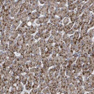 Immunohistochemistry-Paraffin: ACBD4 Antibody [NBP2-14258] - Staining of human liver shows strong cytoplasmic positivity in hepatocytes.