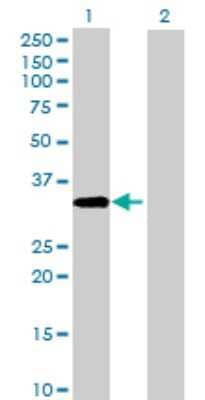 Western Blot: ACBD4 Antibody [H00079777-B01P] - Analysis of ACBD4 expression in transfected 293T cell line by ACBD4 polyclonal antibody.  Lane 1: ACBD4 transfected lysate(33.55 KDa). Lane 2: Non-transfected lysate.