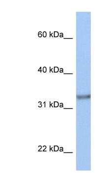 Western Blot ACBD4 Antibody - BSA Free