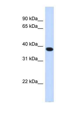 Western Blot ACBD4 Antibody - BSA Free
