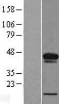 Western Blot: ACBD4 Overexpression Lysate (Adult Normal) [NBL1-07227] Left-Empty vector transfected control cell lysate (HEK293 cell lysate); Right -Over-expression Lysate for ACBD4.