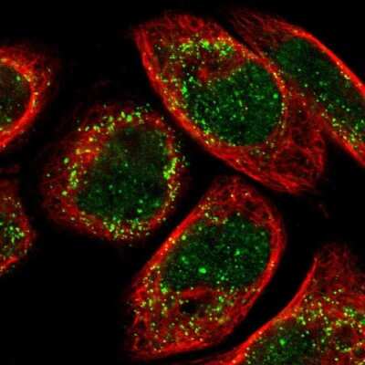 Immunocytochemistry/Immunofluorescence: ACBD5 Antibody [NBP1-85145] - Staining of human cell line A-431 shows localization to nucleus & peroxisomes.