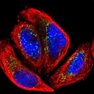 Immunocytochemistry/Immunofluorescence: ACBD5 Antibody [NBP1-85146] - Staining of human cell line A-431 shows localization to peroxisomes. Antibody staining is shown in green.