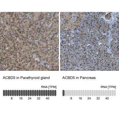 Immunohistochemistry: ACBD5 Antibody [NBP1-85145] - Analysis in human parathyroid gland and pancreas tissues using Anti-ACBD5 antibody. Corresponding ACBD5 RNA-seq data are presented for the same tissues.