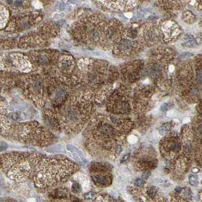 Immunohistochemistry-Paraffin: ACBD5 Antibody [NBP1-85145] - Staining of human adrenal gland.