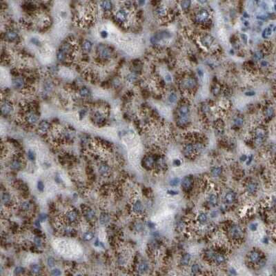 Immunohistochemistry-Paraffin: ACBD5 Antibody [NBP1-85145] - Staining of human liver.