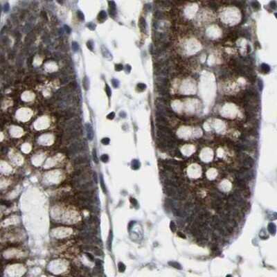 Immunohistochemistry-Paraffin: ACBD5 Antibody [NBP1-85145] - Staining of human colon.