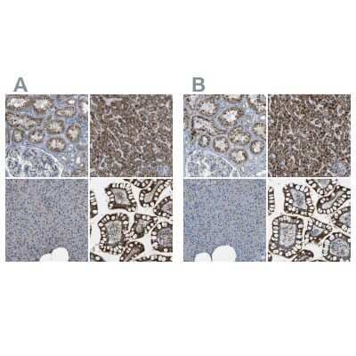 Immunohistochemistry-Paraffin: ACBD5 Antibody [NBP1-85145] - Staining of human kidney, liver, pancreas and small intestine using Anti-ACBD5 antibody NBP1-85145 (A) shows similar protein distribution across tissues to independent antibody NBP1-85146 (B).