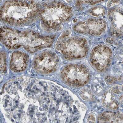 Immunohistochemistry-Paraffin: ACBD5 Antibody [NBP1-85145] - Staining of human kidney shows moderate granular cytoplasmic positivity in cells in tubules.