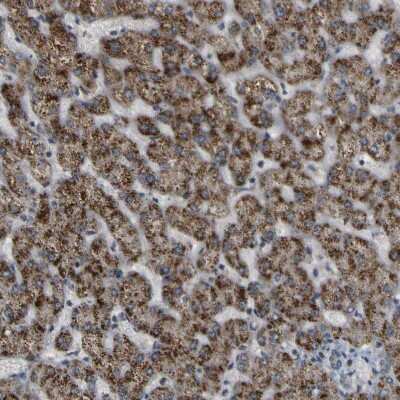 Immunohistochemistry-Paraffin: ACBD5 Antibody [NBP1-85145] - Staining of human liver shows strong granular cytoplasmic positivity in hepatocytes.