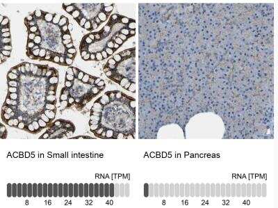 Immunohistochemistry-Paraffin ACBD5 Antibody - BSA Free