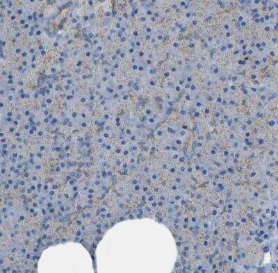 Immunohistochemistry-Paraffin ACBD5 Antibody - BSA Free
