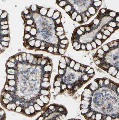 Immunohistochemistry-Paraffin: ACBD5 Antibody [NBP1-85146] - Staining of human small intestine shows strong granular cytoplasmic positivity in glandular cells